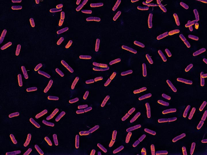 Electron microscopy of E. coli cells